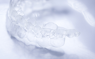 clear aligners