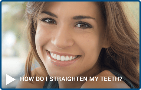 Video-Cover-Image-AAO-How-To-Straighten-My-Teeth.png